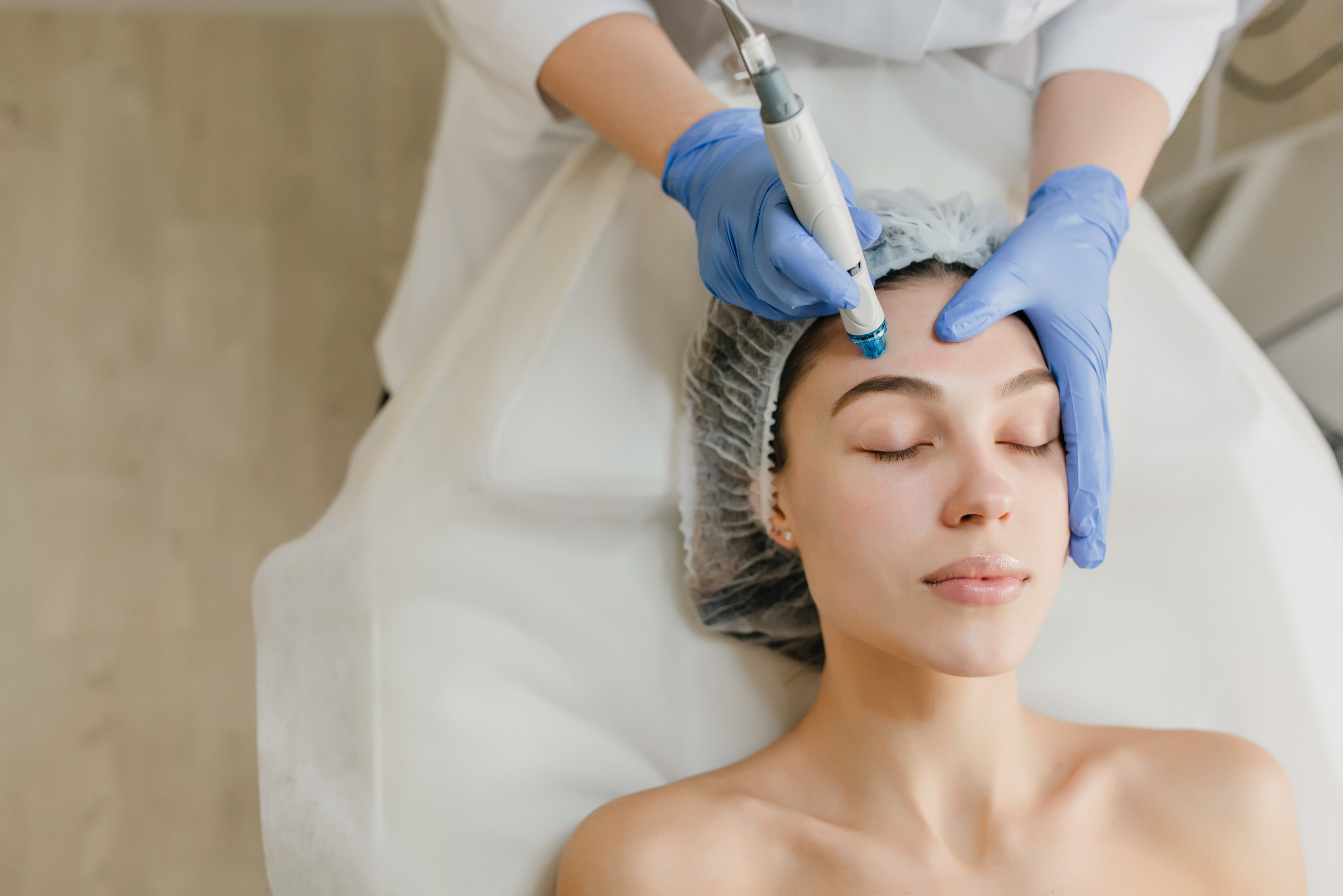 Dermapen Microneedling